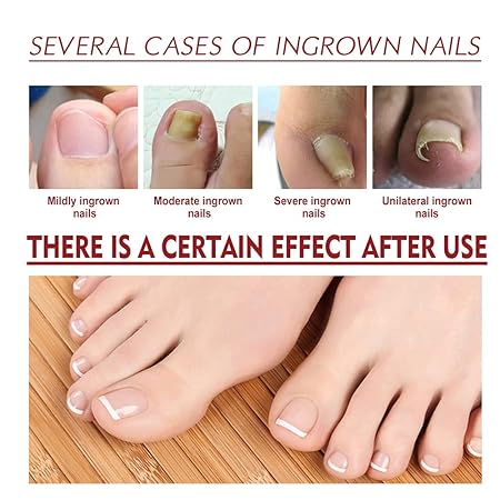 Nail Oil ১ পিছ