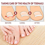Nail Oil ১ পিছ