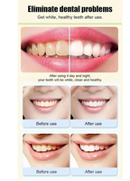 SP 4 Probiotic Whitening Stain Removal Toothpaste 1pc